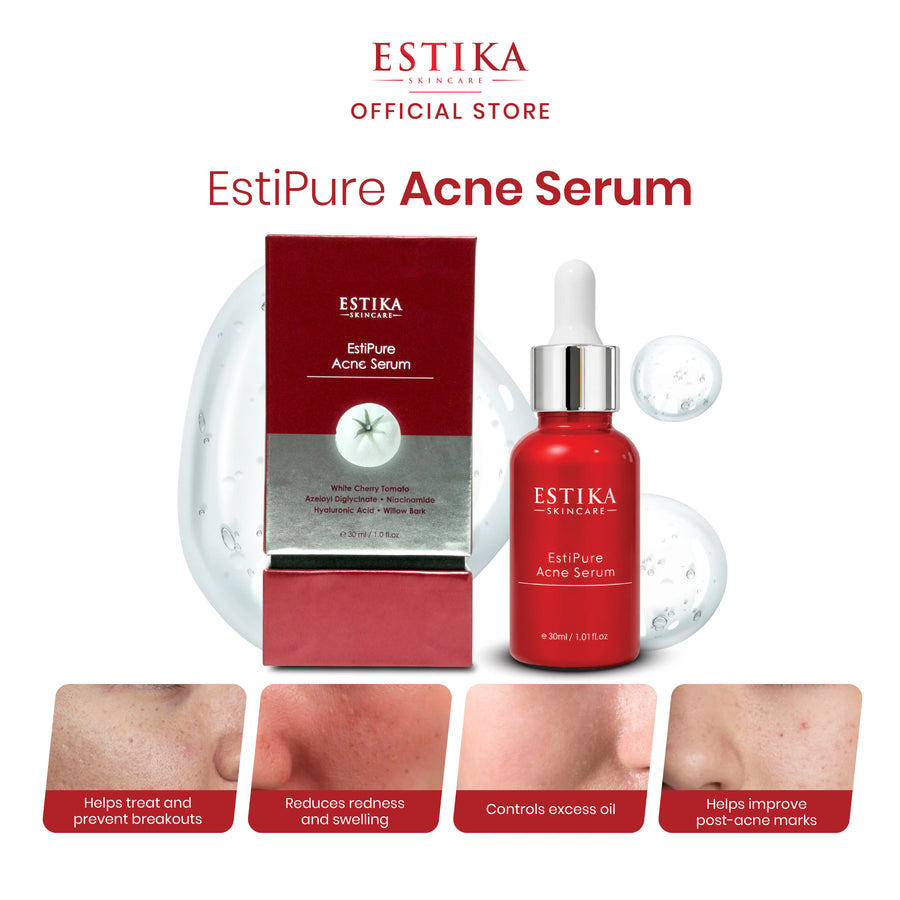 EstiPure Acne Serum
